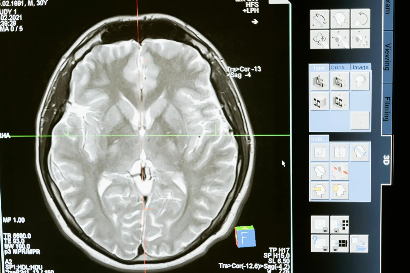 AI-Driven Clinical Intelligence